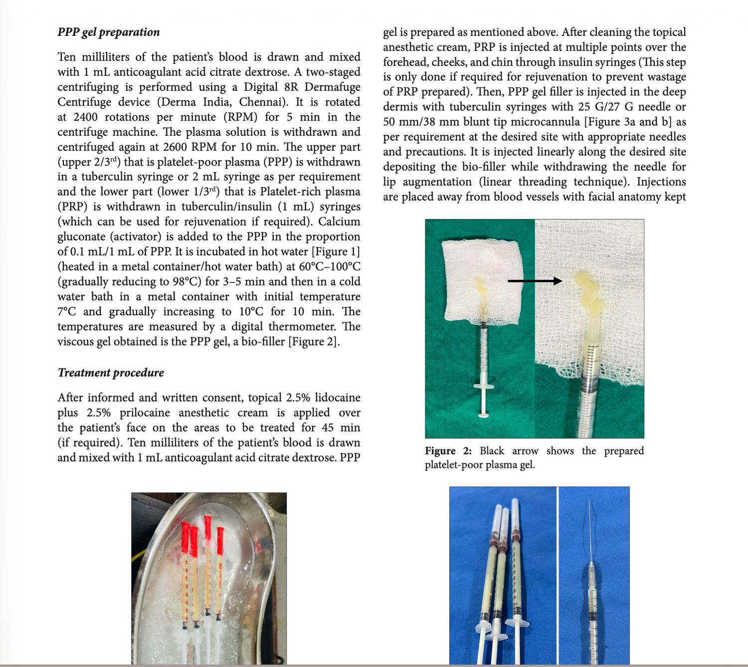 The efficacy, safety, and application of platelet-poor plasma gel as an autologous dermal filler for esthetic enhancements and facial rejuvenation – A pilot study