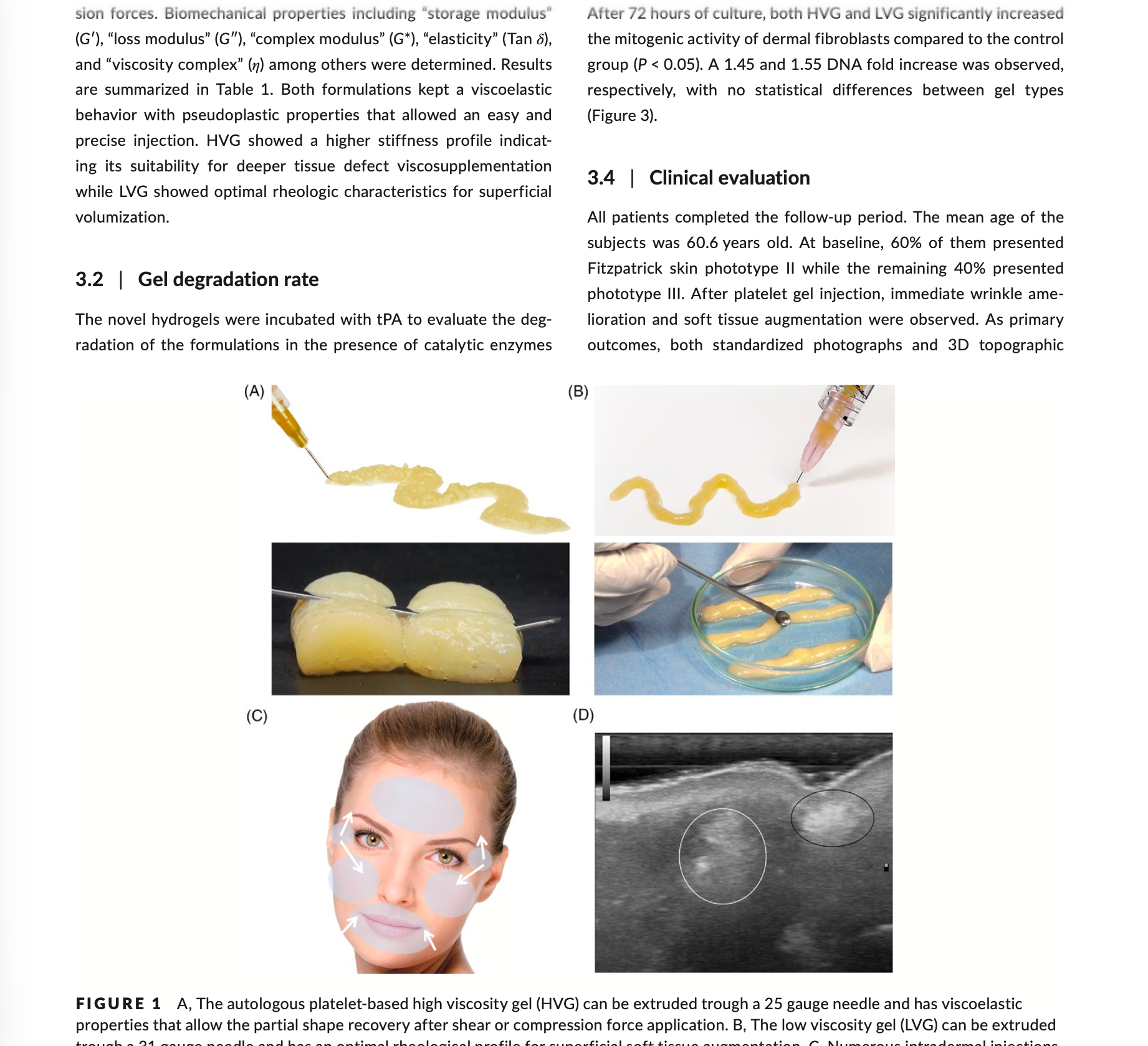 Autologous platelet‐rich gel for facial rejuvenation and wrinkle amelioration: A pilot study
